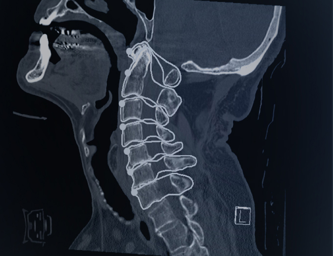 Medical Image Annotation