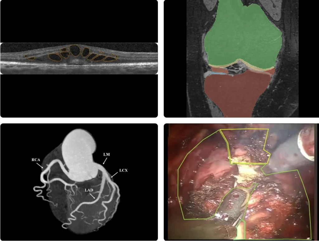 Medical image annotation