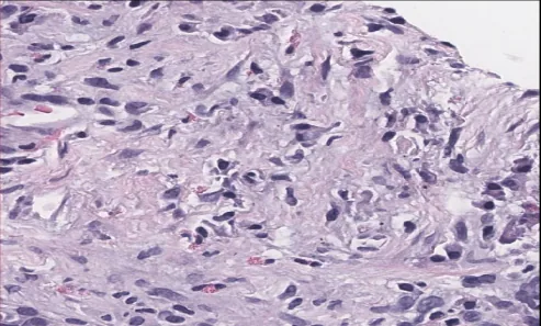 Single Cell