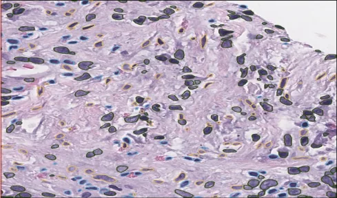 Single Cell