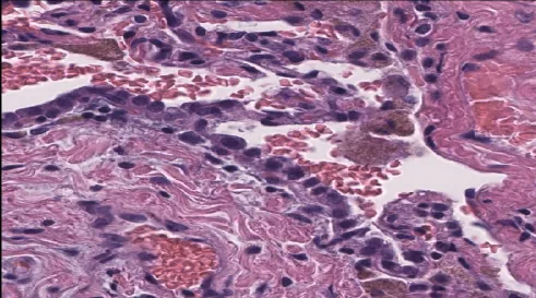 Single Cell