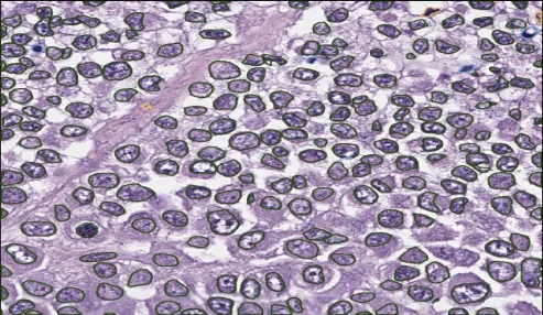 Single Cell